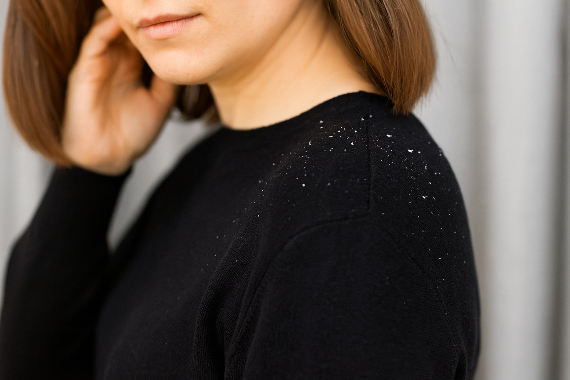 Young woman with dandruff